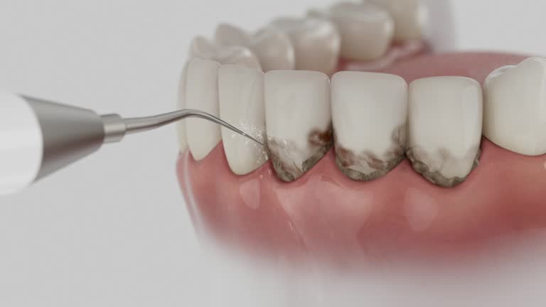 Trusted Teeth Cleaning And Checkup service in Appalachia, VA - Dentist Open Now